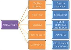 Clinical association with ANA - University of Birmingham | Immunopathology & Immunotherapy | Scoop.it