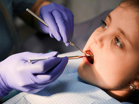When Should You Consider Dental Sealants For Your Child? | Smilepoint Dental Group | Scoop.it