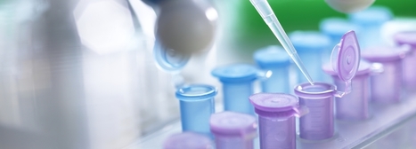 #Cancer : le poids psychologique des #dépistages #génétiques #genome #dépistage #patient #MoiPatient #hcsmeufr  | autour du CANCER | Scoop.it
