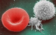 Rayonnements et stress oxydatif : quand le sang est mis à rude épreuve | Life Sciences Université Paris-Saclay | Scoop.it