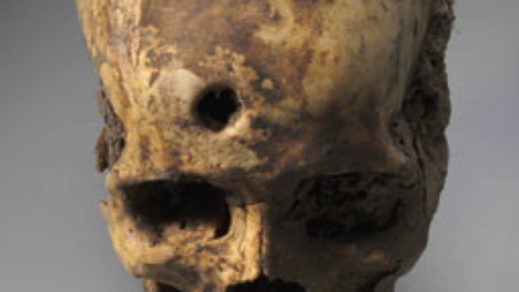 The Lost Civilizations That Pioneered Skull Surgery | Science News | Scoop.it