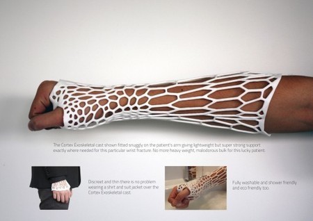 3D-printed Cortex concept scratches the itch of healing broken bones | Longevity science | Scoop.it