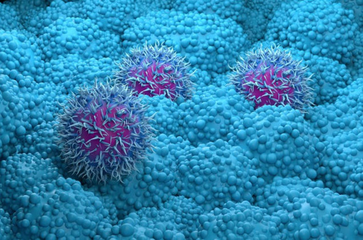 The worst kind of cancer suddenly isn&rsquo;t so scary anymore | The Health Report | Scoop.it