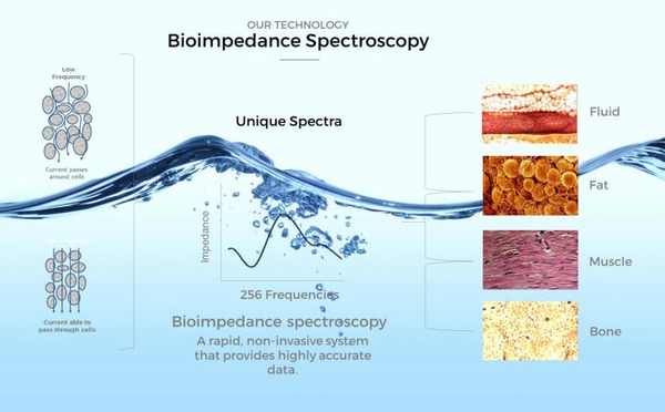 What is BIS? | Peritoneal dialysis | Scoop.it