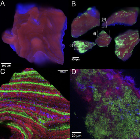 Intercalated bacterial biofilms are intrinsic internal components of calcium-based kidney stones | pnas | RMH | Scoop.it