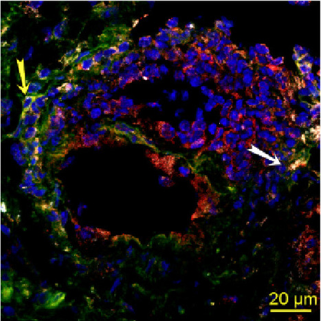 Le tropisme des souches de prions est conservé entre la rate et le granulome | Life Sciences Université Paris-Saclay | Scoop.it