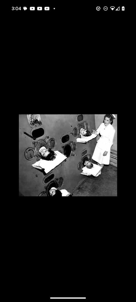 Before the development of the polio vaccine, the world witnessed the devastating effects of the polio pandemic, especially on children. | George Niles Mekeel RN | Hésitations Vaccinales: Observatoire HESIVAXs | Scoop.it