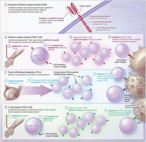 CAR T Cells and T-Cell Therapies for Cancer: A Translational Science Review | Oncology | JAMA | JAMA Network | Immunology and Biotherapies | Scoop.it