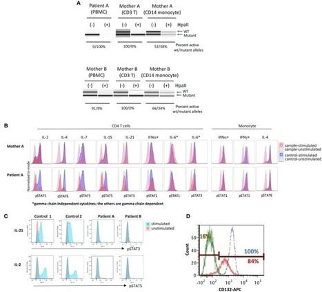 Two Unique Cases of X-linked SCID: A Diagnostic Challenge in the Era of Newborn Screening - Front Pediatr | dépistage néonatal | Scoop.it