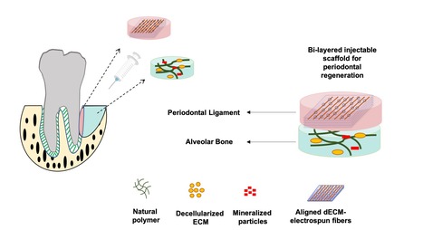 Regeneration of Periodontal Tissues with Hierarchical Biomimetic Scaffolds | iBB | Scoop.it