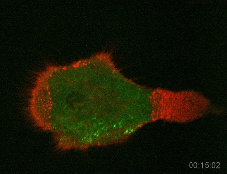 Video showing HIV-1–infected human macrophage sensing its environment- Image CIL:41568 | Immunology for University Students | Scoop.it
