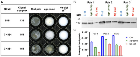 Bacterial metabolic remodeling by convergent evolution unlocks nutrient availability after a host switch | sadv | RMH | Scoop.it
