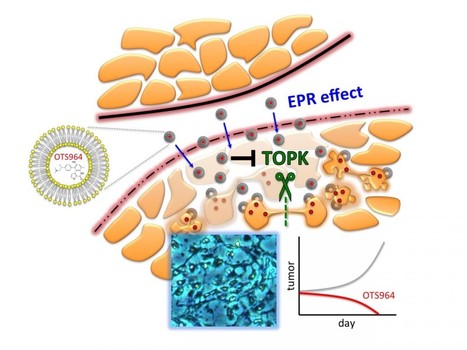 TOPK inhibitor induces complete tumor regression in xenograft models of human cancer through inhibition of cytokinesis - Science | Bioscience News - GEG Tech top picks | Scoop.it