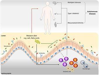 Frontiers | Interrelation of Diet, Gut Microbiome, and Autoantibody Production | Immunology | AUTOIMMUNITY | Scoop.it