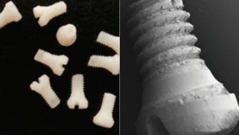Someday, Surgeons Might Fix Your Broken Bones With Screws Made of Silk | 21st Century Innovative Technologies and Developments as also discoveries, curiosity ( insolite)... | Scoop.it