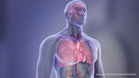 One month of clot prevention after a stent was as effective as year-long course for AFib | Interventional Cardiology | Scoop.it