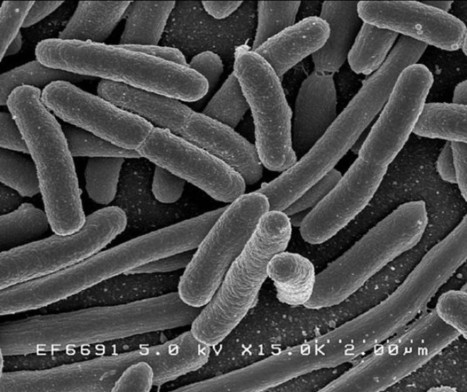 Gut Microbes, Sex Hormones and Autoimmunity Protection | The ... | Immunopathology & Immunotherapy | Scoop.it