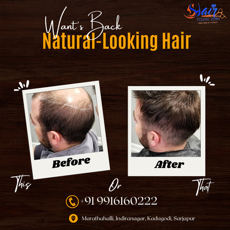 Effortless Hair Restoration: Fullness and Volume | hair fixing in bangalore | Scoop.it