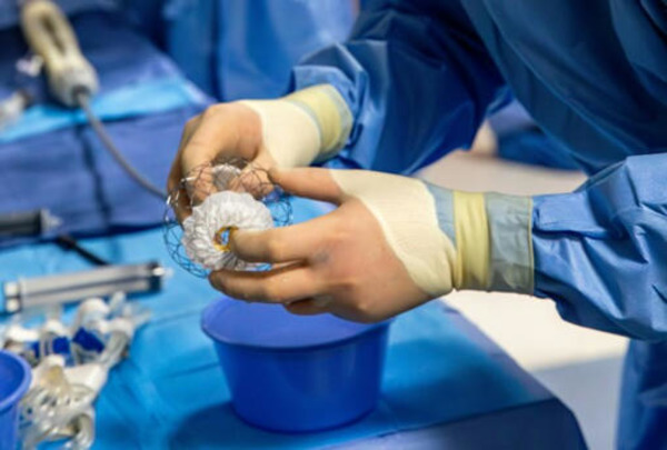 Tampa General Hospital Is the First and Only in the Southeast to Complete Transcatheter Mitral Valve Replacement (TMVR) with AltaValve Technology | Transcatheter Treatment of Mitral Regurgitation | Scoop.it