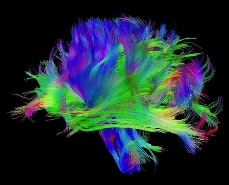 A Neuroscientist&rsquo;s Radical Theory of How Networks Become Conscious | Peer2Politics | Scoop.it