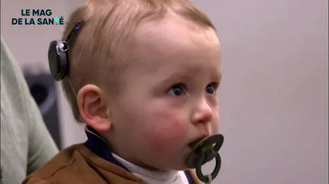 🦻TEASER IN VIVO : Un implant pour entendre &agrave; nouveau | Revue de presse Implant Cochl&eacute;aire | Scoop.it