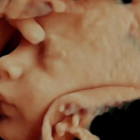 3D Ultrasound Reveals Baby in Color | 21st Century Innovative Technologies and Developments as also discoveries, curiosity ( insolite)... | Scoop.it