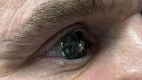 Mojo Smart Contact Lenses with AR Display Trialed for the 1st time | Wearable Tech and the Internet of Things (Iot) | Scoop.it