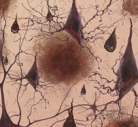 ALZHEIMER : Le gène courant qui accumule Tau avec l’âge | Alzheimer, maladies neuro-dégénératives et gérontologie générale | Scoop.it