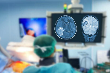 #TumeurCérébrale : un nouveau test fait gagner du temps pour le #diagnostic @nottmhospitals #Cancer #Dépistage #Témoignage #Glioblastome | autour du CANCER | Scoop.it