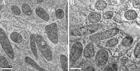 Nitrogen-fixing root nodules elicited by rhizobial potassium ion transporter Smkup1: senescence and autophagy&nbsp; | Plant-Microbe Symbiosis | Scoop.it