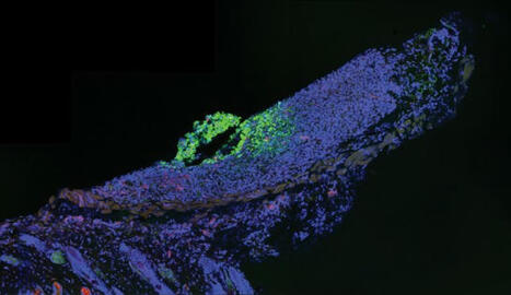 CAR T-Cell Therapy Gets Second Wind after Biomaterials Put Skin in the Game | Healthcare: reloaded... | Scoop.it