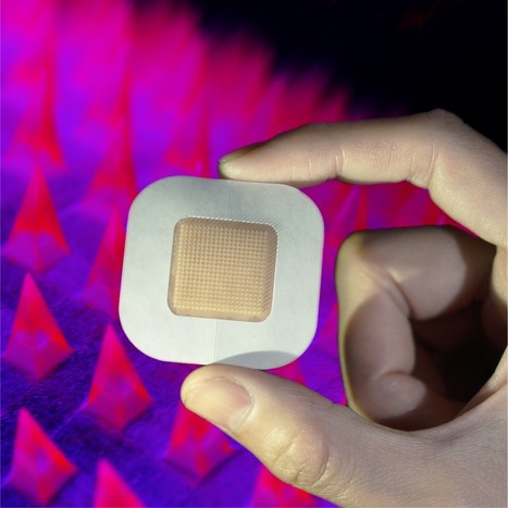 Insulin-delivery patch edges toward human trials | Daily realities of diabetic patients | Scoop.it