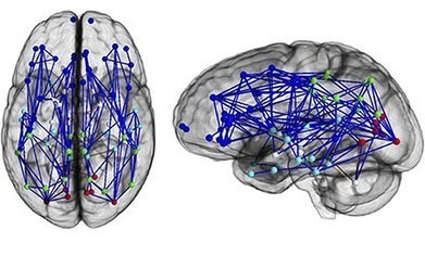 Male and female brains wired differently, scans reveal | consumer psychology | Scoop.it