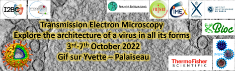 Transmission Electron Microscopy Explore the architecture of a virus in all its forms | I2BC Paris-Saclay | Scoop.it