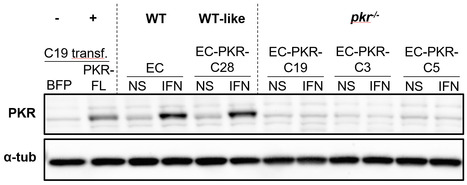Étude fonctionnelle de la protéine kinase ARN double brin-dépendante de salmonidés : de l’activation de l’apoptose à l’inhibition de la synthèse protéique | Life Sciences Université Paris-Saclay | Scoop.it