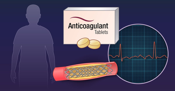 Therapy for Atrial Fibrillation in Patients with Drug-Eluting Stents | Interventional Cardiology | Scoop.it