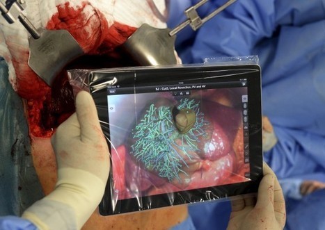 La première opération chirurgicale effectuée à l’aide d’un iPad | Remembering tomorrow | Scoop.it