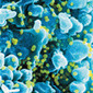 HIV/AIDS: New book tracks the epidemic to its origins | Virology News | Scoop.it