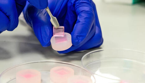 Microneedle patches could speed up diabetic wound healing | Intra-Dermal drug delivery: Opportunities and Challenges? | Scoop.it