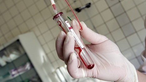 Blood test might make Parkinson's diagnosis easier | #ALS AWARENESS #LouGehrigsDisease #PARKINSONS | Scoop.it