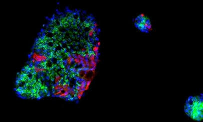 Insights into how COVID outsmarts the gut's immune response could point to new treatments | Mucosal Immunity | Scoop.it