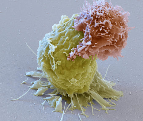 Discovery of new T-cell raises prospect of ‘universal’ cancer therapy  | Genetic Engineering Publications - GEG Tech top picks | Scoop.it