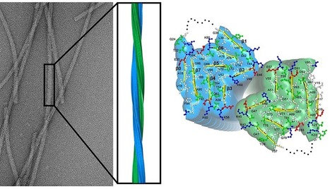 Maladie de Parkinson : voyage au c&oelig;ur de l&rsquo;alpha-synucl&eacute;ine | Life Sciences Universit&eacute; Paris-Saclay | Scoop.it