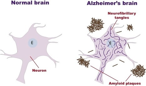 Neuroinflammation in Alzheimer’s disease | Generalidades sobre Neurología | Scoop.it