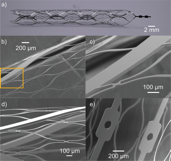 Thin-Film Patient-Specific Flow Diverter Stents for the Treatment of Intracranial Aneurysms | Neurovascular Intervention | Scoop.it