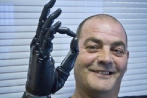 Bebionic: Bionic Hands Are Getting Closer To The Real Thing | Longevity science | Scoop.it