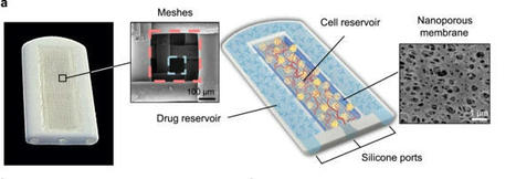 Researchers 3D print implant for diabetes type1 | 3DM-Shop news | Scoop.it