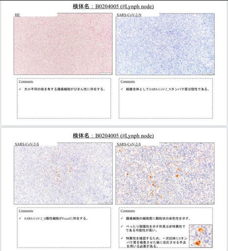 ‏原口　一博 (@kharaguchi) on X‏ | ‏Christiane Calande‏ | Hésitations Vaccinales: Observatoire HESIVAXs | Scoop.it
