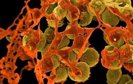 Current Trends in Antibiotic Resistance - Dr. Jennifer Conroy | Temas varios sobre Microbiología clínica | Scoop.it