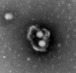 Hepatitis A virus discovered to cloak itself in membranes hijacked from infected cells | Virology News | Scoop.it
